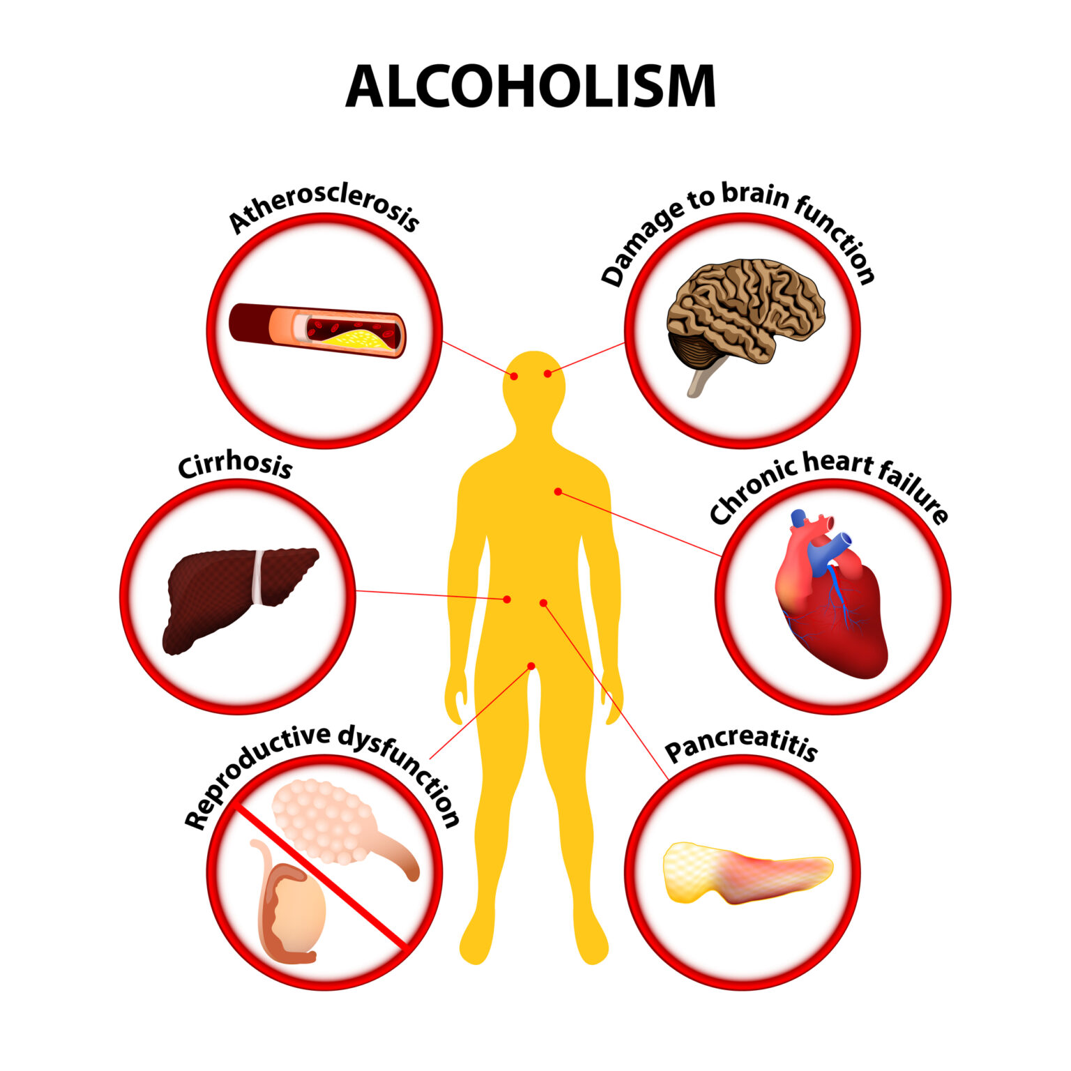 can-alcoholism-negatively-impact-your-health-racnj